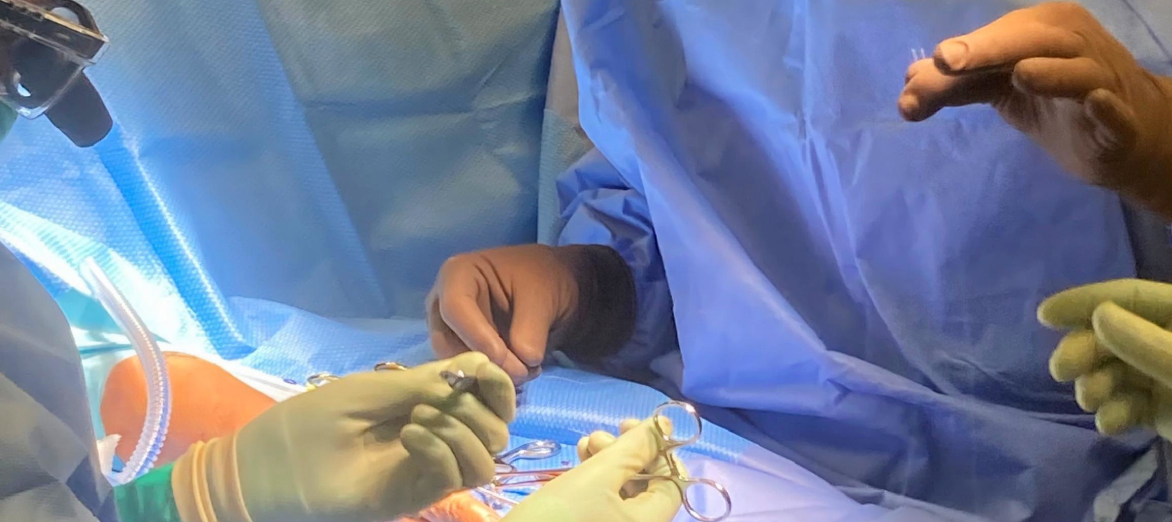 Surgeon performing delicate hand microsurgery